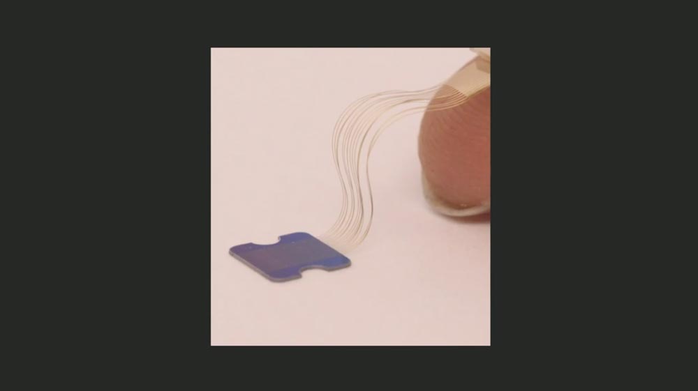 Neuralinks Spezialfasern f&uuml;r die Gehirndaten&uuml;bertragung. Bild: Neuralink
